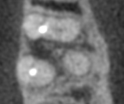 CT画像：CTでは歯をあごの下の方向からのぞいた状態